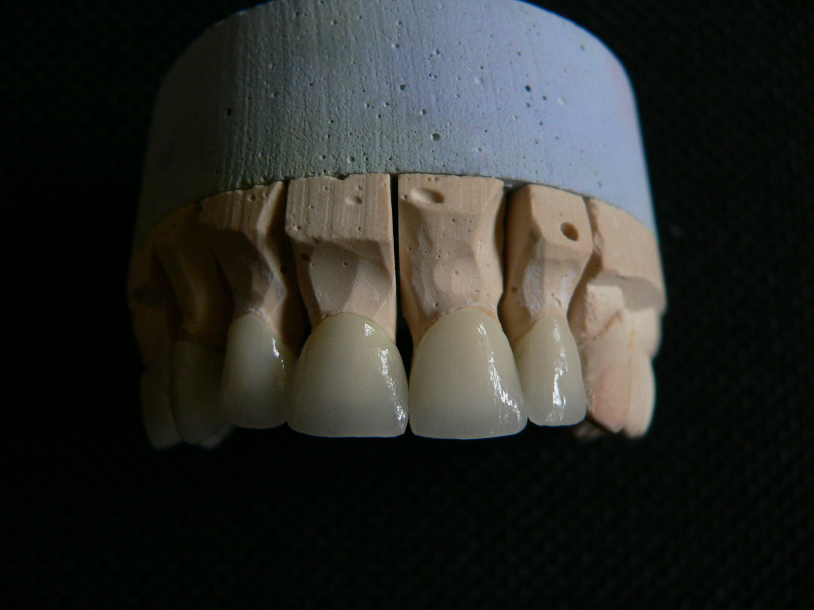 Zahnbehandlung in Ungarn